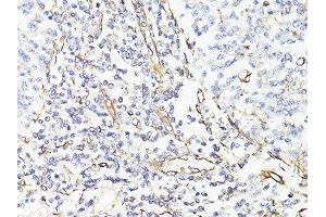 Immunohistochemistry of paraffin-embedded human tonsil using VIM antibody. (Vimentin 抗体  (AA 1-101))