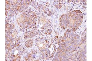 IHC-P Image Immunohistochemical analysis of paraffin-embedded SW480 xenograft, using MAAI, antibody at 1:100 dilution. (GSTZ1 抗体)