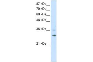 WB Suggested Anti-RNF113B Antibody Titration:  1. (RNF113B 抗体  (C-Term))