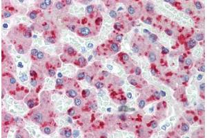 Human Liver (formalin-fixed, paraffin-embedded) stained with CFH antibody ABIN462334 followed by biotinylated anti-mouse IgG secondary antibody ABIN481714, alkaline phosphatase-streptavidin and chromogen. (Complement Factor H 抗体)