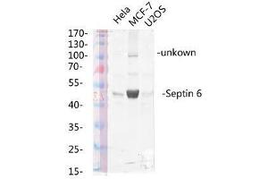 Western Blot (WB) analysis of specific lysis using Septin 6 Polyclonal Antibody. (Septin 6 抗体  (Internal Region))