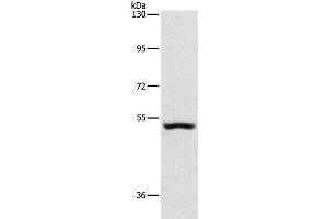 Western Blot analysis of Mouse kidney tissue using SYT17 Polyclonal Antibody at dilution of 1:650 (SYT17 抗体)