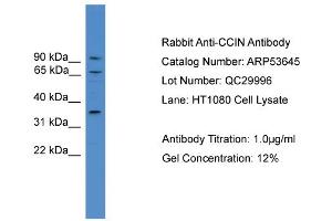WB Suggested Anti-CCIN  Antibody Titration: 0.