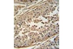 Immunohistochemistry analysis in formalin fixed and paraffin embedded human testis tissue reacted with FBXO24 Antibody  followed by peroxidase conjugation of the secondary antibody and DAB staining. (FBXO24 抗体  (Middle Region))
