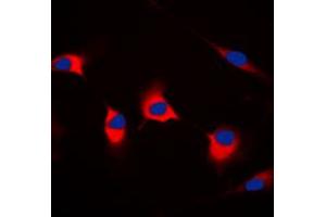 Immunofluorescent analysis of CDKL4 staining in MCF7 cells. (CDKL4 抗体  (C-Term))