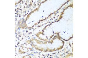 Immunohistochemistry of paraffin-embedded human stomach using NUDT15 antibody. (NUDT15 抗体)