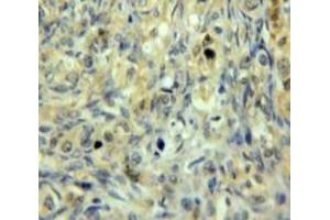 Used in DAB staining on fromalin fixed paraffin-embedded Ovary tissue (GSTM3 抗体  (AA 8-223))