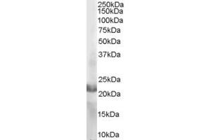 Western Blotting (WB) image for anti-Ras-Related C3 Botulinum Toxin Substrate 2 (Rho Family, Small GTP Binding Protein Rac2) (RAC2) (C-Term) antibody (ABIN184689)