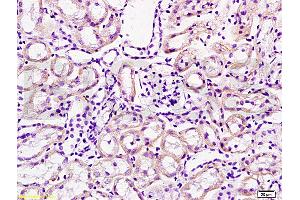 Immunohistochemistry (IHC) image for anti-Cathepsin H (CTSH) (AA 71-170) antibody (ABIN732758)
