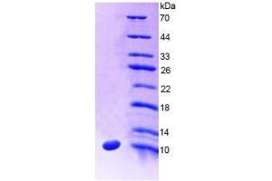 SDS-PAGE analysis of Human SLC30A8 Protein. (SLC30A8 蛋白)