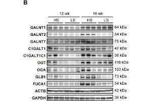 Upregulation of glycogene expression in the LV of DS hypertensive rats. (GLB1 抗体)