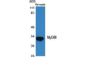 Western Blot (WB) analysis of specific cells using MyD88 Polyclonal Antibody. (MYD88 抗体  (Internal Region))