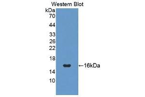 Western blot analysis of the recombinant protein. (PIGR 抗体  (AA 135-237))