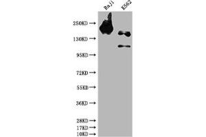 Western Blot Positive WB detected in: Raji whole cell lysate, K562 whole cell lysate All lanes: INPP5D antibody at 1:1500 Secondary Goat polyclonal to rabbit IgG at 1/50000 dilution Predicted band size: 134, 110 kDa Observed band size: 145 kDa (Recombinant INPP5D 抗体)