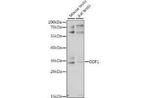 Western blot analysis of extracts of various cell lines, using ODF1 antibody (ABIN7269127) at 1:1000 dilution. (ODF1 抗体  (AA 80-180))