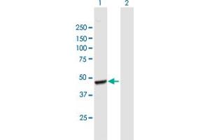 Western Blot analysis of AACS expression in transfected 293T cell line by AACS MaxPab polyclonal antibody. (AACS 抗体  (AA 1-410))