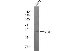 Lane 1: A431 lysates, probed with MCT1 Polyclonal Antibody, Unconjugated  at 1:300 overnight at 4˚C. (MCTS1 抗体  (AA 251-350))