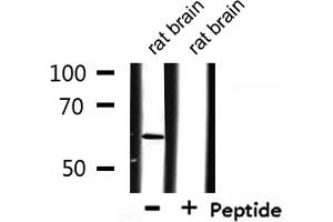 Western blot analysis of extracts from rat brain, using CSTF2 Antibody. (CSTF2 抗体  (N-Term))