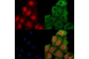 ABIN6262398 and ABIN6269012 staining Hela cells by IF/ICC. (HSP70 抗体  (C-Term))