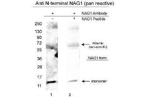 Western blot using  affinity purified anti-NAG-1/GDF15 (N-terminal specific) antibody shows detection of a 14 kDa band corresponding to recombinant human NAG-1 purified from CHO cells. (GDF15 抗体  (N-Term))