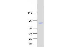Western Blotting (WB) image for Neuro-Oncological Ventral Antigen 1 (NOVA1) (Transcript Variant 2) protein (Myc-DYKDDDDK Tag) (ABIN2727489)