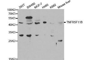 Western blot analysis of extracts of various cell lines, using TNFRSF11B antibody. (Osteoprotegerin 抗体  (AA 22-280))