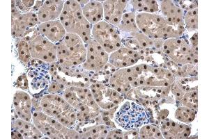 Immunohistochemistry (IHC) image for anti-Ubiquitin Fusion Degradation Protein 1 Homolog (UFD1L) (full length) antibody (ABIN2856688)
