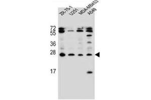 Western blot analysis of Endothelin-1 Antibody (C-term) in ZR-75-1, U251, MDA-MB453, A549 cell line lysates (35ug/lane). (Endothelin 1 抗体  (C-Term))