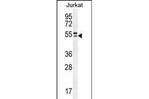 TRIM59 Antibody (N-term) (ABIN655580 and ABIN2845072) western blot analysis in Jurkat cell line lysates (35 μg/lane). (TRIM59 抗体  (N-Term))