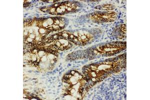 Anti-beta Catenin antibody, IHC(F) IHC(F): Rat Intestine Tissue (CTNNB1 抗体  (C-Term))