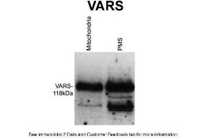 WB Suggested Anti-VARS Antibody Titration: 1 ug/mlPositive Control: Wildtype Neurospora crassa (VARS 抗体  (Middle Region))