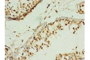 Immunohistochemistry of paraffin-embedded human testis tissue using ABIN7165811 at dilution of 1:100 (MIS12 抗体  (AA 1-305))
