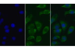 Detection of AMH in Human Hela cell using Monoclonal Antibody to Anti-Mullerian Hormone (AMH) (AMH 抗体  (AA 19-560))