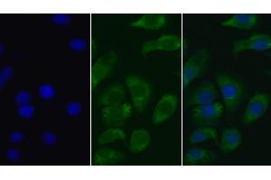 Detection of AMH in Human Hela cell using Monoclonal Antibody to Anti-Mullerian Hormone (AMH) (AMH 抗体  (AA 19-560))