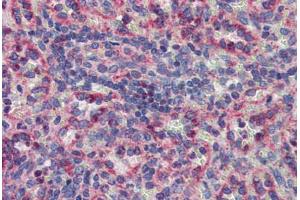 Spleen, Human: Formalin-Fixed, Paraffin-Embedded (FFPE) (MKNK2 抗体  (AA 36-85))