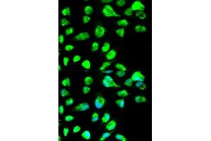 Immunofluorescence analysis of MCF-7 cells using LIG3 antibody. (LIG3 抗体)