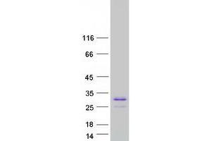 Validation with Western Blot (PRB1 Protein (Transcript Variant 3) (Myc-DYKDDDDK Tag))