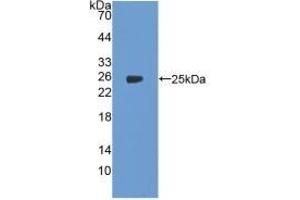 Detection of Recombinant PTGS2, Human using Polyclonal Antibody to Cyclooxygenase-2 (COX 2) (COX2 抗体  (AA 418-589))