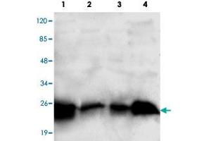 Western blot analysis of RAB2A monoclonal antibody  at 1:1000 dilution. (RAB2A 抗体  (C-Term))