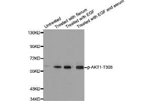 Western Blotting (WB) image for anti-V-Akt Murine Thymoma Viral Oncogene Homolog 1 (AKT1) (pThr308) antibody (ABIN1869972) (AKT1 抗体  (pThr308))