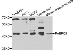 Western blot analysis of extracts of various cells, using PABPC5 antibody. (PABPC5 抗体)