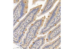 Immunohistochemistry of paraffin embedded mouse small intestine using PTPN3 (ABIN7075298) at dilution of 1:700 (300x lens) (PTPN3 抗体)