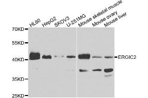 Western blot analysis of extracts of various cell lines, using ERGIC2 antibody. (ERGIC2 抗体  (AA 55-310))