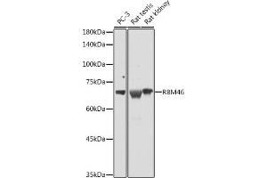 Western blot analysis of extracts of various cell lines, using RBM46 antibody (ABIN7270086) at 1:1000 dilution. (RBM46 抗体  (AA 1-140))