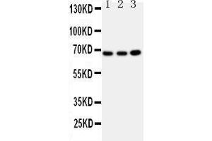 Western Blotting (WB) image for anti-Guanylate Binding Protein 1, Interferon-Inducible (GBP1) (AA 566-589), (C-Term) antibody (ABIN3042677) (GBP1 抗体  (C-Term))