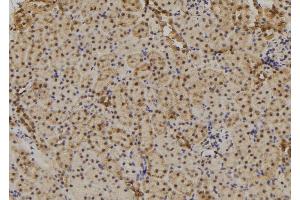 ABIN6277711 at 1/100 staining Mouse kidney tissue by IHC-P. (TAB1 抗体  (C-Term))