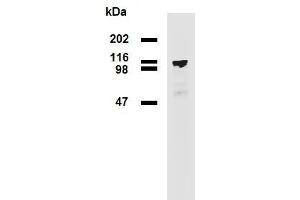 Western blotting analysis (reducing conditions) of PDE8a in HEK293T/17-PDE8a transfectants using mouse monoclonal antibody EM-52 . (PDE8A 抗体)