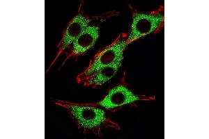 Fluorescent image of PC12 cells stained with Pink1(115-213) Antibody (ABIN387803 and ABIN2843897).