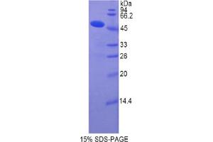 SDS-PAGE (SDS) image for Collagen, Type XIV, alpha 1 (COL14A1) protein (ABIN3008902)