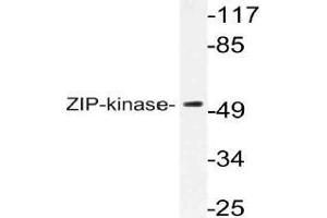 Western blot (WB) analysis of ZIP-kinase antibody in extracts from HuvEc cells. (DAPK3 抗体)